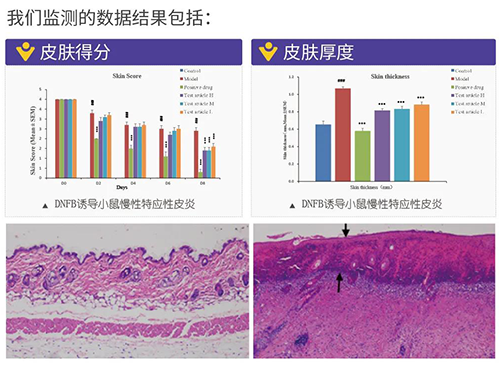 龙8唯一官网建立的特应性皮炎及湿疹模型监测数据结果