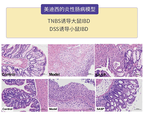 龙8唯一官网的炎症性肠病模型