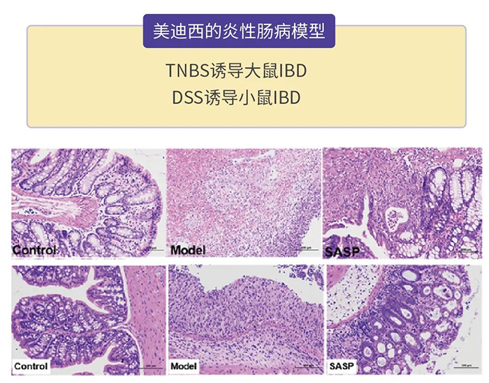 龙8唯一官网的炎性肠病模型.png