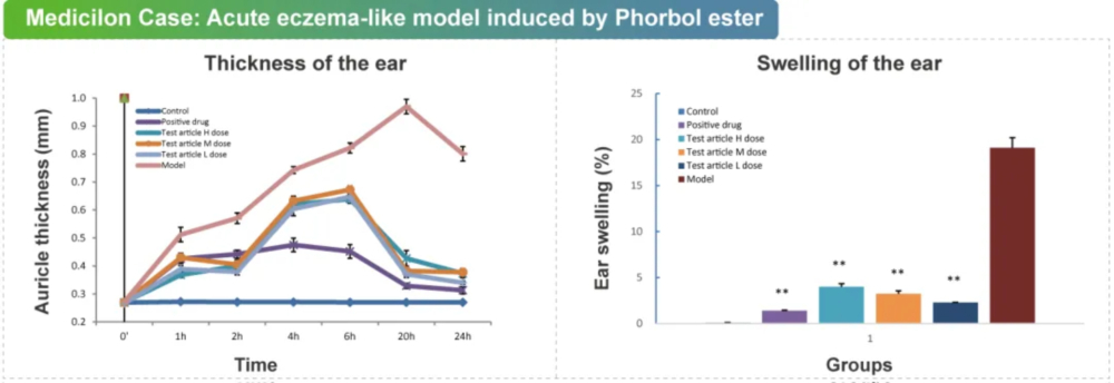 07 佛波酯诱导的急性湿疹样模型.jpg